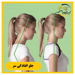 فیزیوتراپی