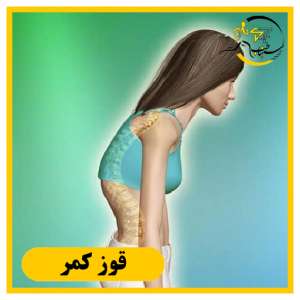 تاثیرات منفی قوز هنگام نشستن