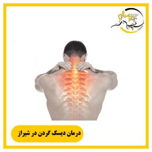 درمان دیسک گردن در شیراز